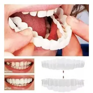 Carillas dentales