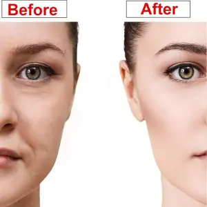 Ventosa Masaje Facial Estiramiento Piel