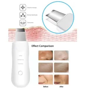 Limpiador Ultrasónico facial