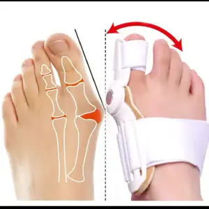 CORRECTOR DE JUANETES