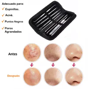 EXTRACTOR ESPINILLA PROFESIONAL 9 PCS