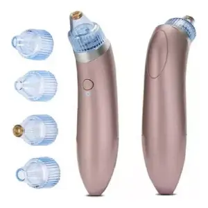 Extractor de puntos negros