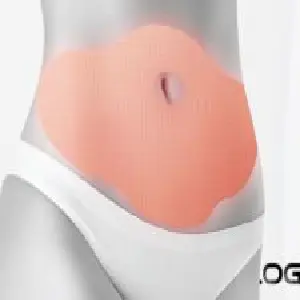 Tq Parche Abdomen