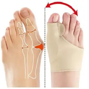 Corrector de juanetes