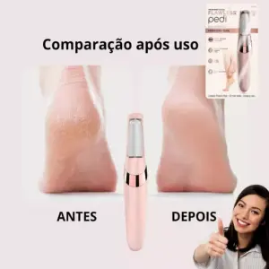 Kit Pulidor Para Pies + Repuesto
