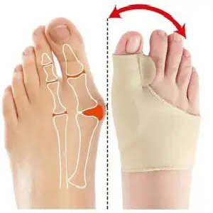 Corrector juanete