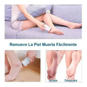 Removedor De Callos Para Pies Recargable