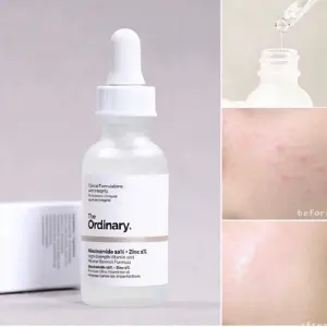 The Ordinary Niacinamida Grande