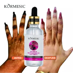 SERUM BLANQUEADOR DE NUDILLOS Y CODOS