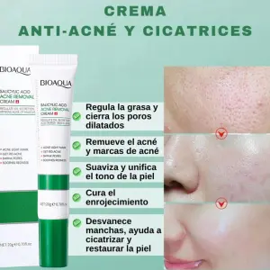 CREMA ANTI-ACNÉ DE ÁCIDO SALICÍLICO BIOA