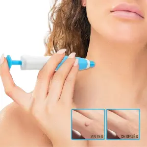 Kit Quita verrugas con accesorios 23D280