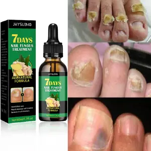 ACEITE PARA UÑAS