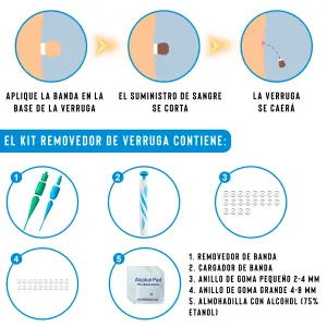 Removedor De Verrugas
