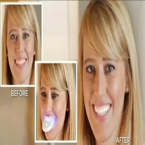 Blanqueador Dental LED 20 minutos: Sonrisa Radiante en Casa - Blanqueador Dental LED 20minutes