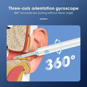OTOSCOPIO INALAMBRICO INTELIGENTE
