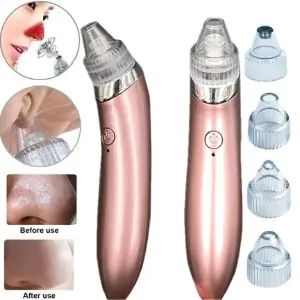 Extractor de Puntos Negros