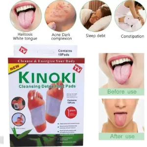 Parches Desintoxicantes Kinoki x 30