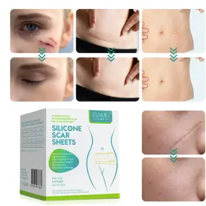 Cinta de Silicona para Quitar Cicatrices: Tu Piel, Renovada - Cinta De Silicona Para Quitar Cicatrices