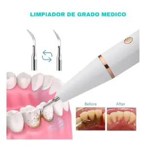 Limpiador De Dientes Eléctrico 3en1