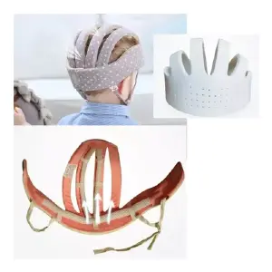 Casco Protector Para Bebes Antigolpes