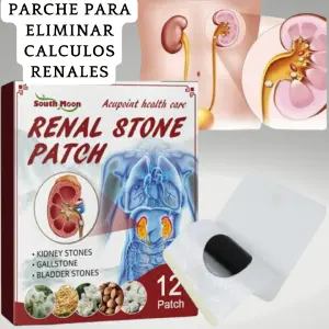 parches para eliminar calculos renales