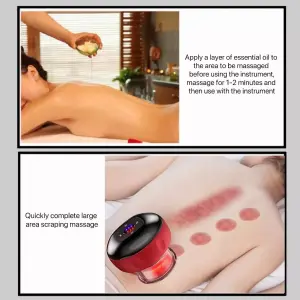 Vacumterapia Manual Recargable Terapia V