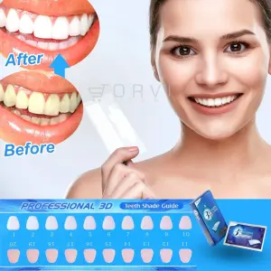 BLANQUEADOR DENTAL 3D WHITE X7