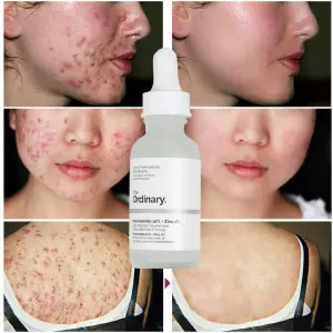 The Ordinary Niacinamida 10%