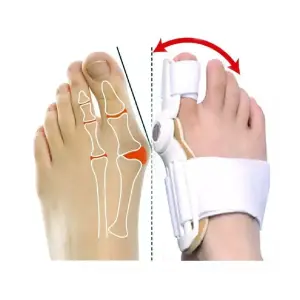 Corrector de Juanetes Férula Alivio