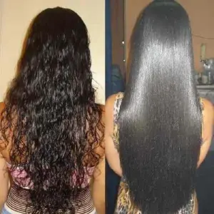 ALISADOR SOFT MDT