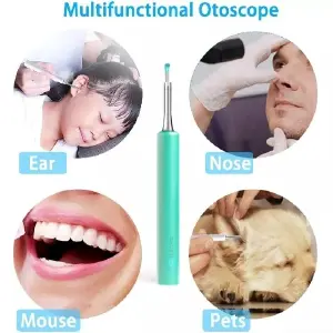 Otoscopio Digital Inalámbrico