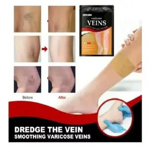 Parches varices x2