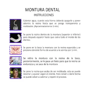 Montura Carillas Dentales Postizas: Sonríe con Confianza - Montura Carillas dentales postizas