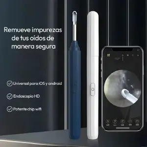 Otoscopio para Oído con Cámara: Visualización Clara y Precisa - Otoscopio para oido con Cámara