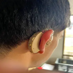 Audífonos para sordera con pilas ⚡
