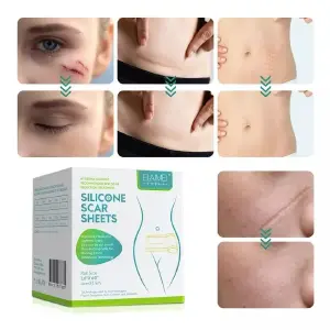 Cinta de Silicona para Cicatrices: Tu Aliada para una Piel Sana - Cinta De Silicona Para Cicatrices
