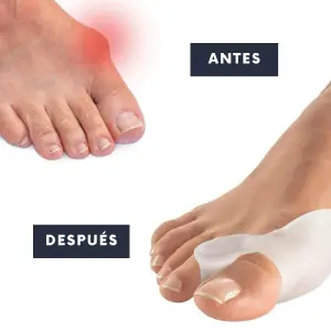 SEPARADOR Y  CORRECTOR DEDOS