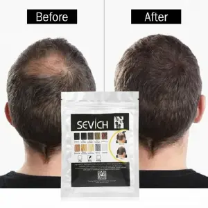 Recarga Sevich: Revitaliza tu Cabello al Instante - Recarga Sevich Fibras Capilares