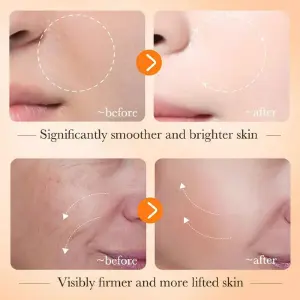SERUM VITAMINA C Y ÁCIDO HIALURÓNICO BIOAQUA: ¡Piel Radiante y Joven! - SERUM VITAMINA C Y ACIDO HIALURO BIOAQUA
