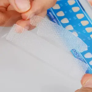 Carillas Dentales + Pegamento: Sonríe con Confianza - carilla dental +pegatina dental