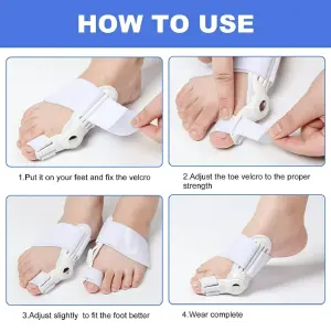 Corrector de Juanetes: Recupera la Comodidad y la Belleza de tus Pies - Corrector de juanetes