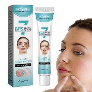 Crema Facial Acné Tratamiento FK23B-39: Tu Solución para una Piel Sana y Radiante - Crema facial acné tratamiento FK23B-39