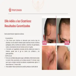 Crema Reparadora para Manchas y Cicatrices - Crema para las manchas Scar cream