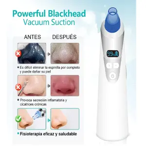 Extractor Quita Espinillas Digital Blanc: Tu Piel, Perfecta y Radiante - Extractor Quita espinillas Digital Blanc