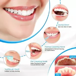 Limpiador Dental Ultra: Limpieza Profunda para una Sonrisa Radiante - Limpiador dental ultra