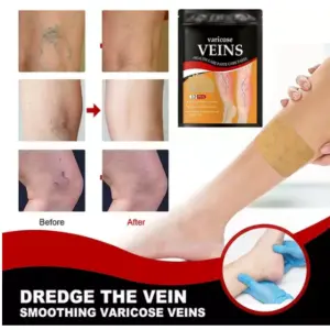 Parche para Venas Varices: VariPatch - Parche para Venas Varices