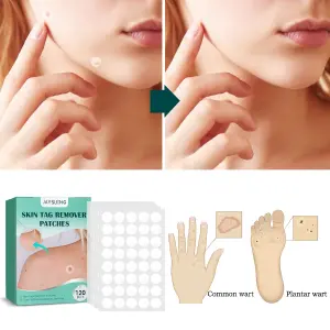 PARCHES LAMINA SILICONA ELIMINA VERRUGAS: La Solución Segura y Eficaz - PARCHES LAMINA SILICONA ELIMINA VERRUGAS