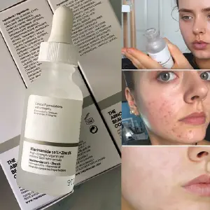 The Ordinary Niacinamida: Suero Facial para Piel Radiante - The ordinary niacinamida
